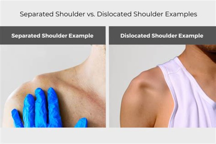 Can you dislocate your shoulder while sleeping?