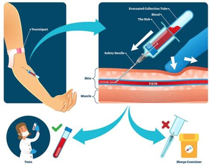 How do you describe phlebotomy experience?