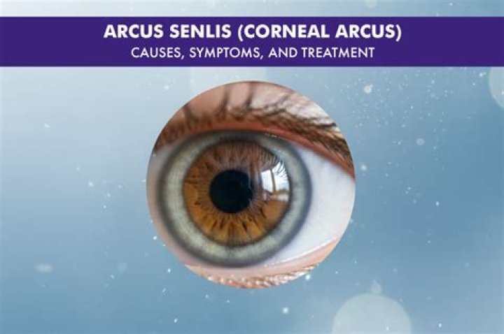 Is Arcus a name?