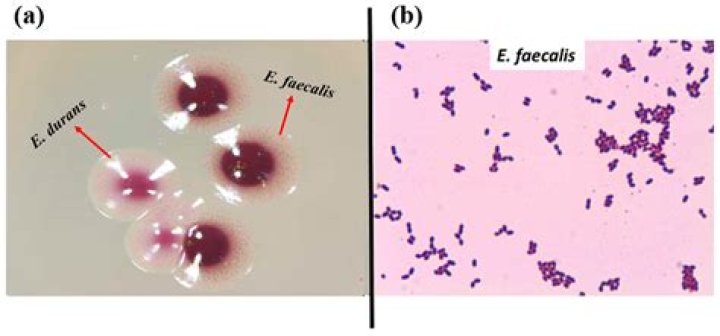 Is Enterococcus faecalis the same as Enterococcus faecium?