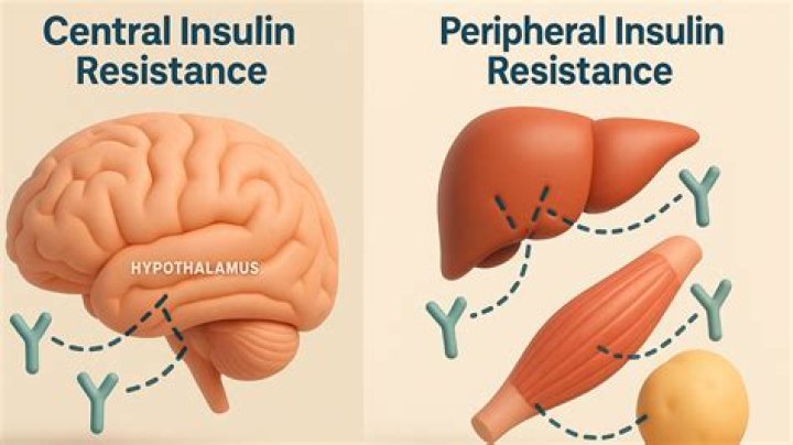 What is peripheral insulin resistance?