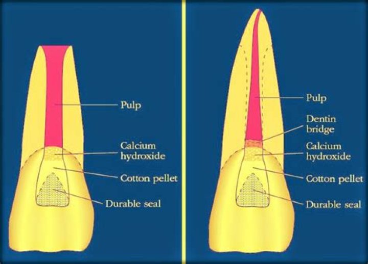 What is radicular pulp?