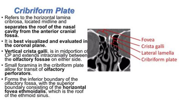 Where is lamina Cribrosa located?